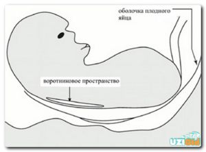 Воротниковое пространство