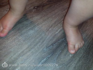 Беспокойный ребенок 1 год, поджимает пальчики на ногах