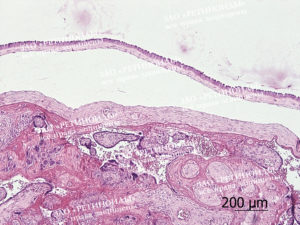 Гистология плаценты