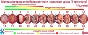 Какой аборт делать на 4 неделе