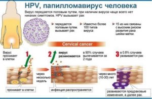 ВПЧ 16. Лечение при беременности?