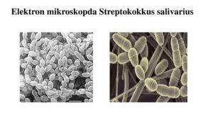 Обнаружен стрептококк salivarius 10*4 нужно ли лечить?