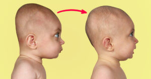 Плоский затылок у ребёнка в 4 месяца
