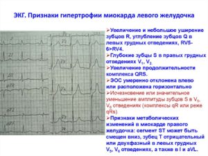 Изменения миокарда левого желудочка