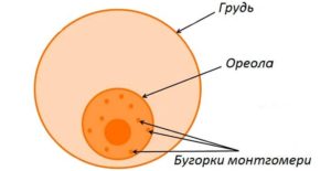 Прыщ на ореоле