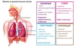 Непроизвольный выдох во время засыпания на фоне бронхита