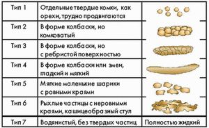 Запоры, твердый кал