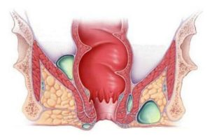 Сухость слизистой в прямой кишке
