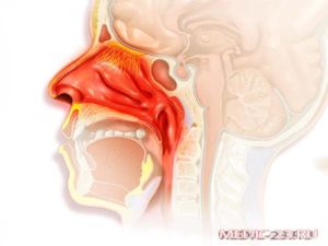 Заложенность носа когда ложусь