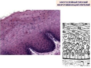 Расшифровка гистологии: Фрагмент многослойного плоского эпителия без подлежащих тканей