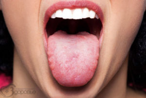 Онемение языка, нёба, носа