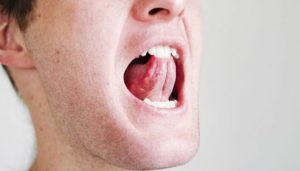 Проблемы с горлом и языком