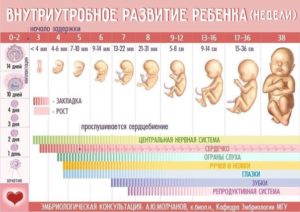 Какой аборт делать на 4 неделе