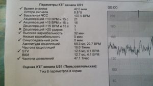 Расшифровка результатов КТГ