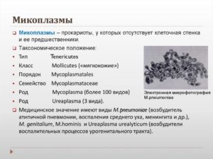 Микоплазма в зеве