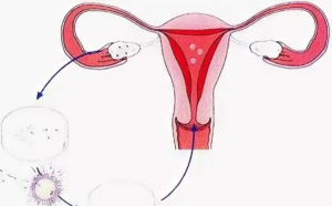 Нет менструаций после Регивидона
