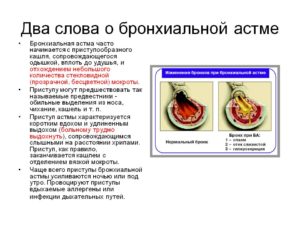 Влажный кашель при бронхиальной астме у ребенка