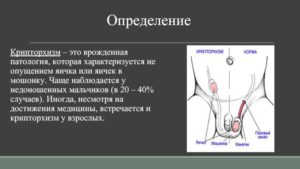 Крипторхизм, мошонка, яички, гормоны