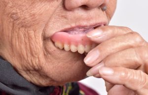 Жжение и боль языка после протезирования