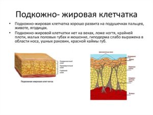 Утолщение жировой клетчатки