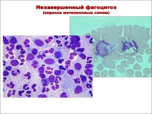 Кокко-бациллы фагоцитоз незавершенный