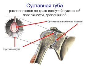 Повреждения передних отделов суставной фиброзно-хрящевой губы гленоида