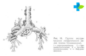 Внутригрудные лимфатические узлы, очаги в легких