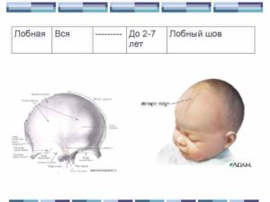 Выступающая бороздка или черепной шов на голове у ребенка