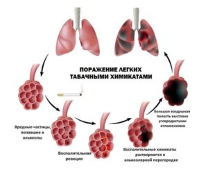 Боль в груди от курения