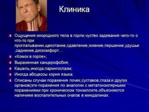 Ощущение посторонний. Ощущение инородного тела в горле. Ощущение инородного тела в глотке. Ощущение инородного тела в горле причины. Ощущение инородного тела в носоглотке.