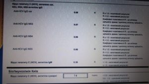 Расшифровка анализа на гепатит В и С
