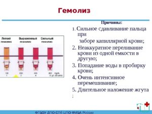 Свернулась кровь при заборе для анализа