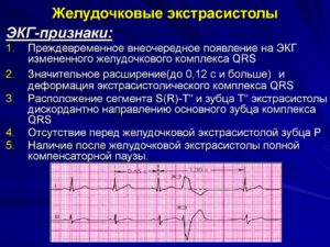 Беременность и сильные экстрасистолы