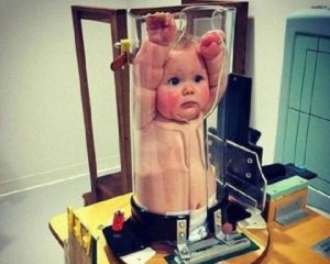 Рентген у ребенка 2 лет