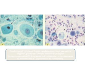 Парабазальные клетки в анализе на цитологию