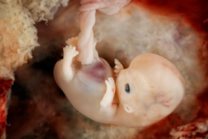 Плохо растет эмбрион