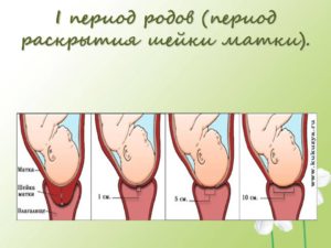 Шейка матки 2 см