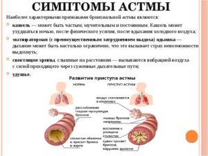 Влажный кашель при бронхиальной астме у ребенка