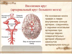 Сужение просвета по обеим задним соединительным артериям