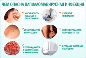 Инкубационный период ВПЧ и ИППП
