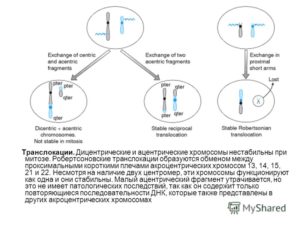 Робертсоновская транслокация 13,14 хромосомы