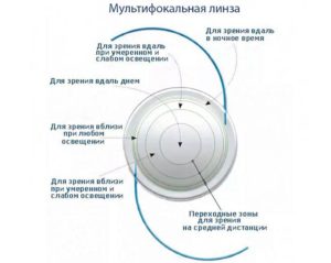 Мультифокальный хрусталик