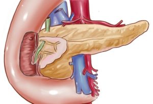 Уплотнение поджелудочной железе