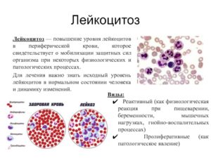 Низкие лейкоциты и другие изменения крови