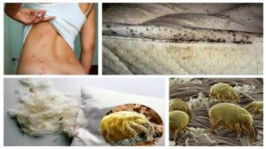 Аллергия на перьевую подушку