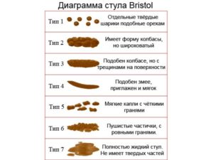 Запоры, твердый кал