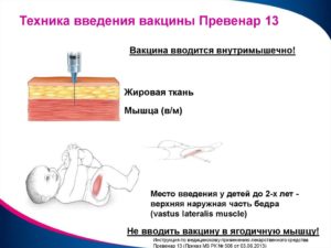 Вакцинация АКДС-Превенар-13