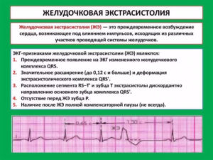 Беременность и сильные экстрасистолы