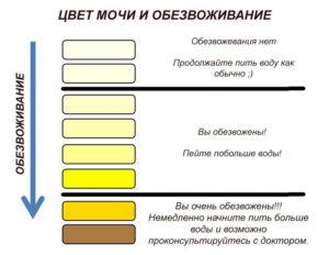 Моча ярко жёлтого цвета