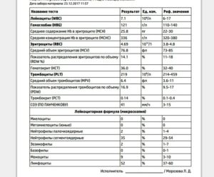 Эозинофилы у ребенка повышены до 28